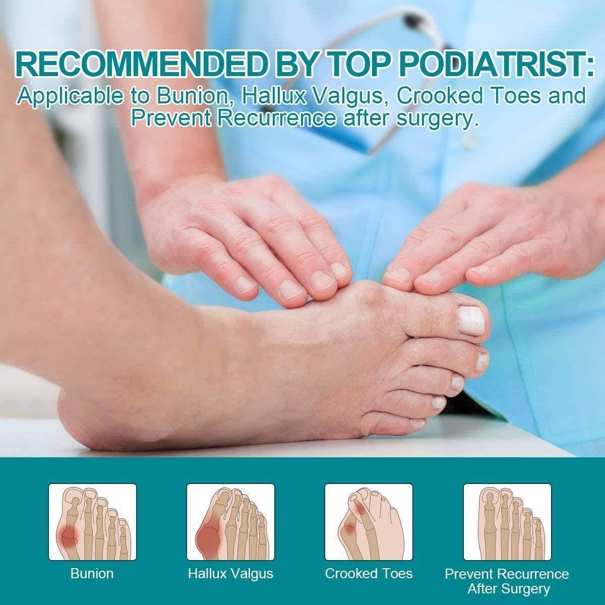 shebonsn Bunion Corrector for Women and Men, 1 Pair Adjustable Soft Bunion Pad Big Toe Straighteners Separators.<br /><br />

This  Bunion Brace Bunion Corrector for Crooked Toes Alignment is an excellent choice for people with bunions. This brace helps to prevent the chances that you will eventually have to have surgery by correcting your bunion over a long period of time. This toe joint pain relief brace aids in easing the discomfort of your feet so that you can go about your day comfortably. This brace gives sore feet relief and corrects toe alignment.<br /><br />